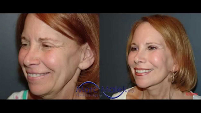 Dr. Malek's Media Appearances